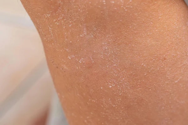 sữa tắm trắng da