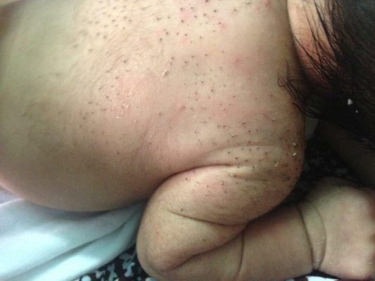 sữa tắm làm rụng lông cho trẻ sơ sinh